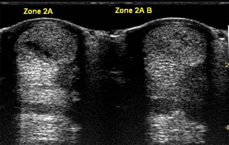 Effective treatment of tendon and ligament injuries Effective treatment of tendon and ligament injuries